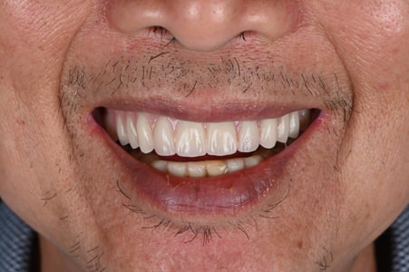 The Sydney Implant Institute