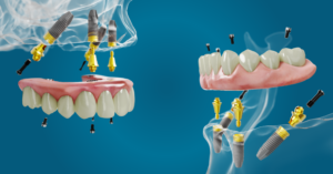 The Sydney Implant Institute