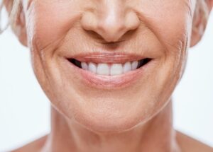 front dental implants